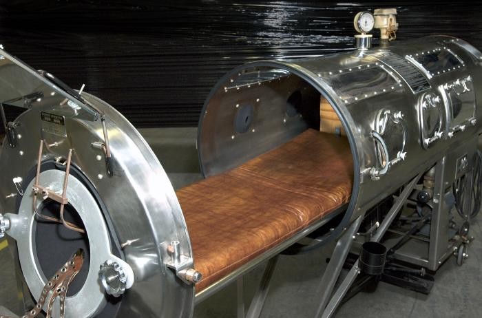 Iron lungs cost about $1,500 in the 1930’s