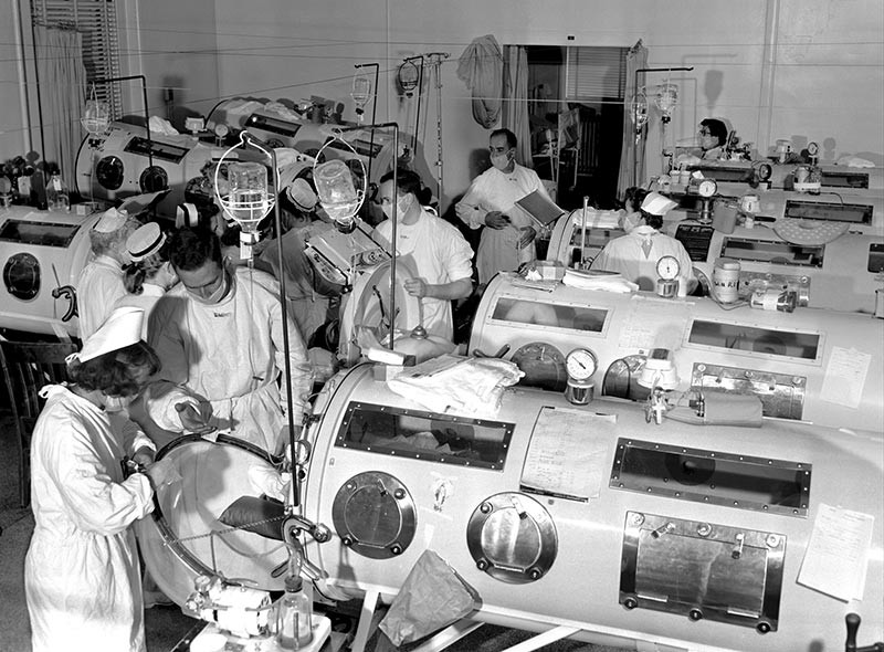 The iron lung polio peaked in 1952.